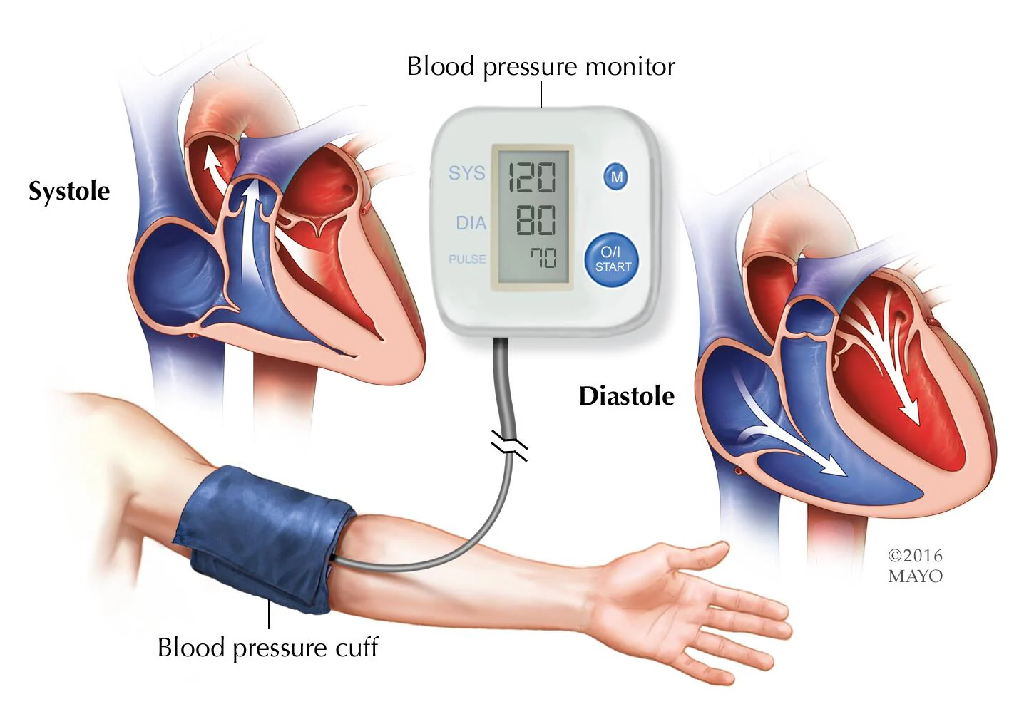 “Understanding and Managing High Blood Pressure: A Comprehensive Guide”